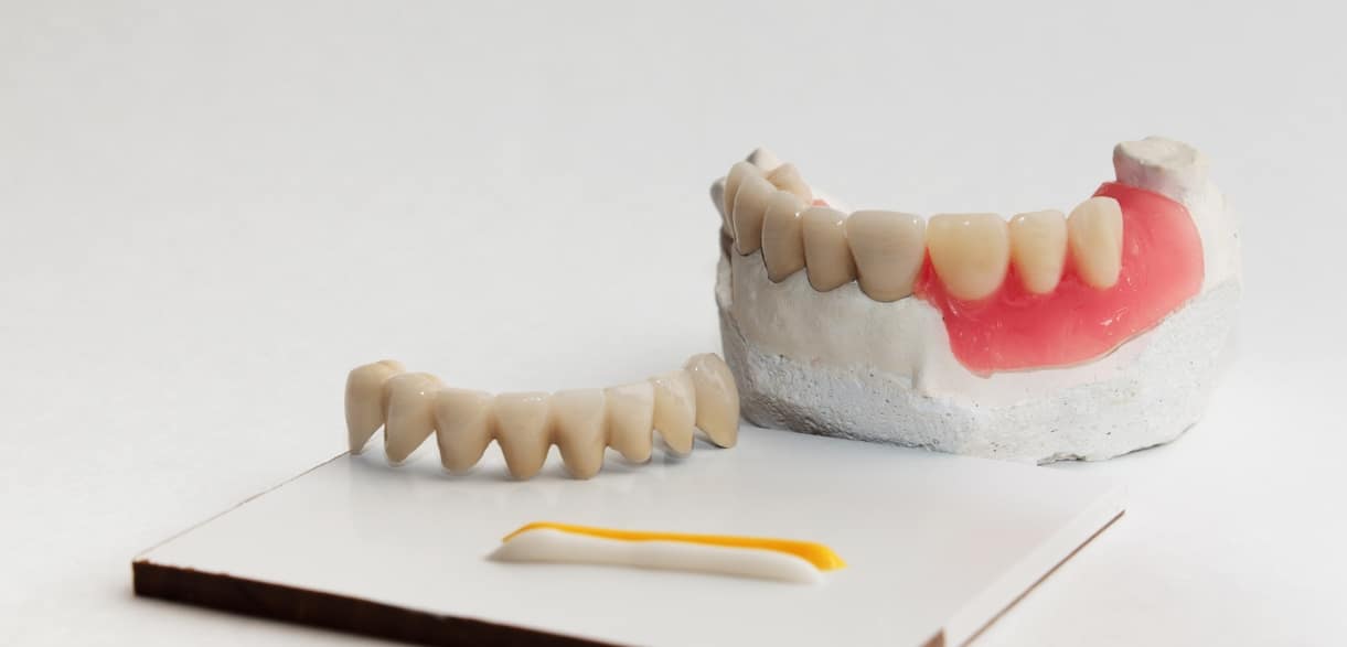 Dissolving Dental Cement at Home A Guide